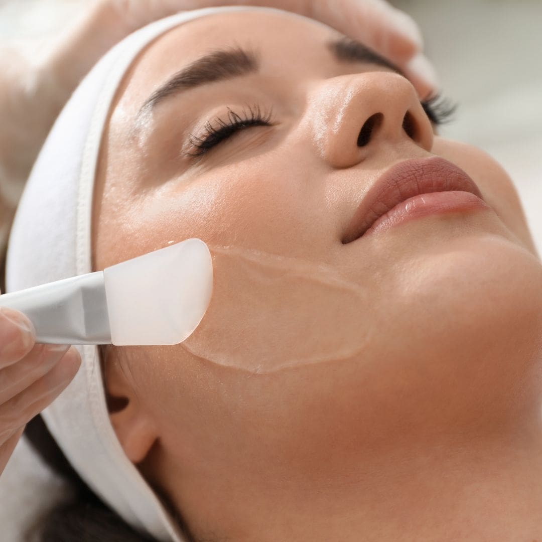 Chemical Peels in Jacksonville, FL